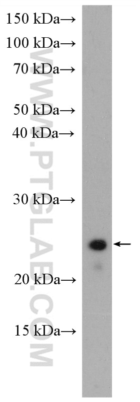 Western Blot (WB) analysis of Jurkat cells using ARL6IP6 Polyclonal antibody (16956-1-AP)