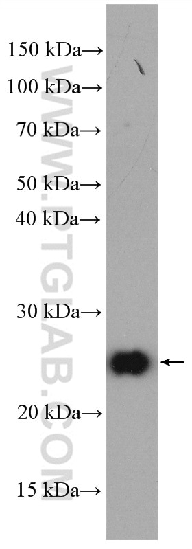 Western Blot (WB) analysis of human placenta tissue using ARL6IP6 Polyclonal antibody (16956-1-AP)