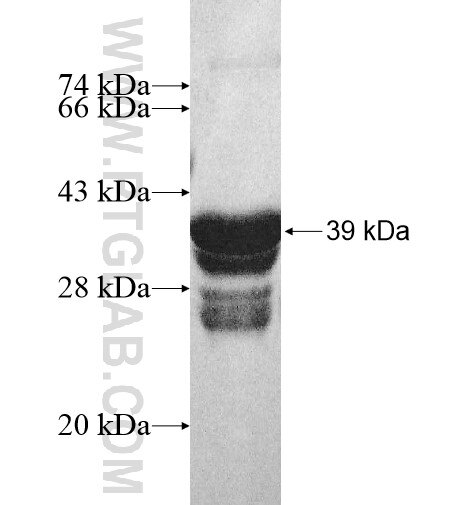 ARL6IP6 fusion protein Ag10598 SDS-PAGE