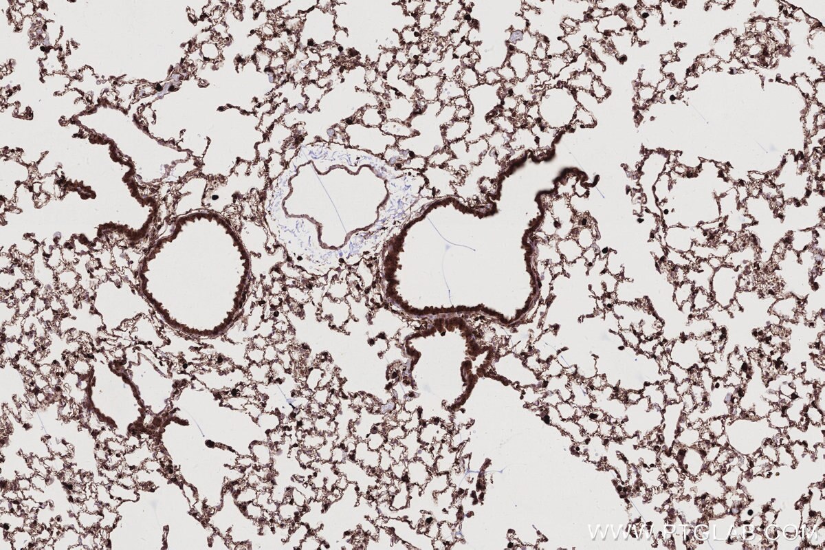 Immunohistochemistry (IHC) staining of mouse lung tissue using ARL8A/ARL8B Monoclonal antibody (68186-1-Ig)