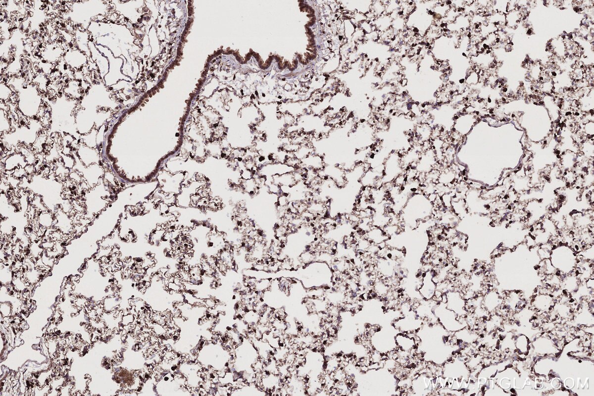 Immunohistochemistry (IHC) staining of rat lung tissue using ARL8A/ARL8B Monoclonal antibody (68186-1-Ig)