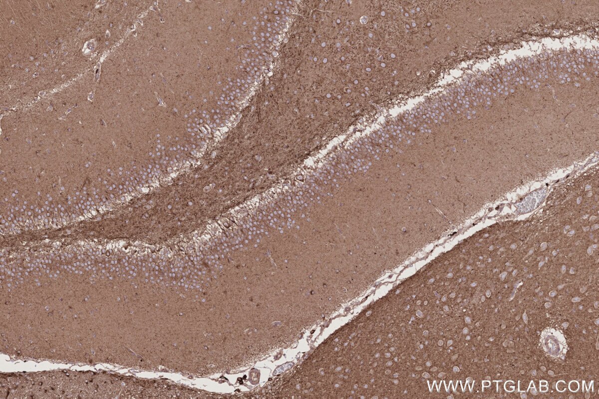 Immunohistochemistry (IHC) staining of rat brain tissue using ARL8A/ARL8B Monoclonal antibody (68186-1-Ig)
