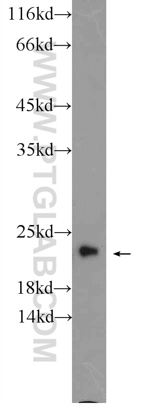 Western Blot (WB) analysis of mouse brain tissue using ARL8A Polyclonal antibody (17060-1-AP)