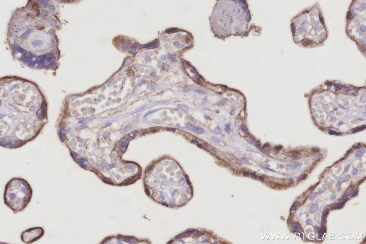 Immunohistochemistry (IHC) staining of human placenta tissue using ARL8B Polyclonal antibody (13049-1-AP)