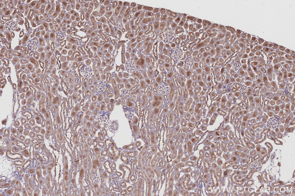 Immunohistochemistry (IHC) staining of mouse kidney tissue using ARL8B Polyclonal antibody (13049-1-AP)
