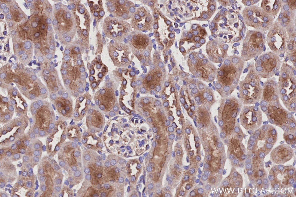 Immunohistochemistry (IHC) staining of mouse kidney tissue using ARL8B Polyclonal antibody (13049-1-AP)