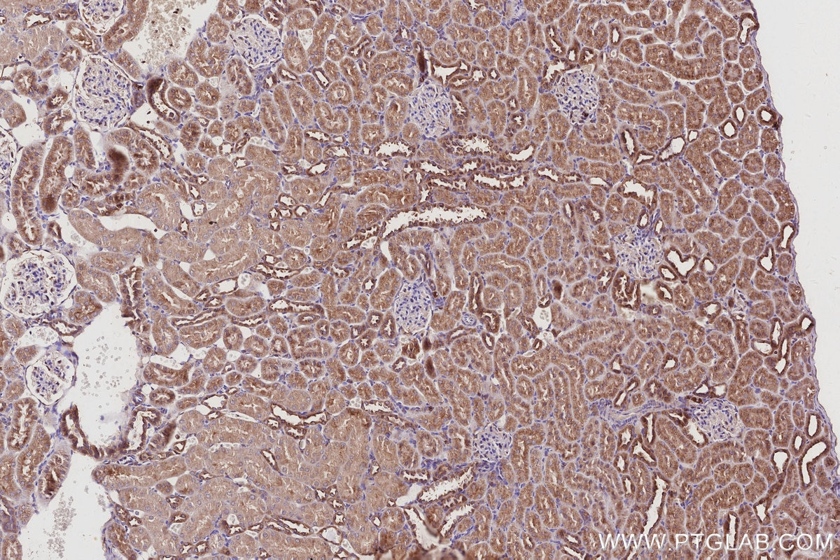 Immunohistochemistry (IHC) staining of rat kidney tissue using ARL8B Polyclonal antibody (13049-1-AP)