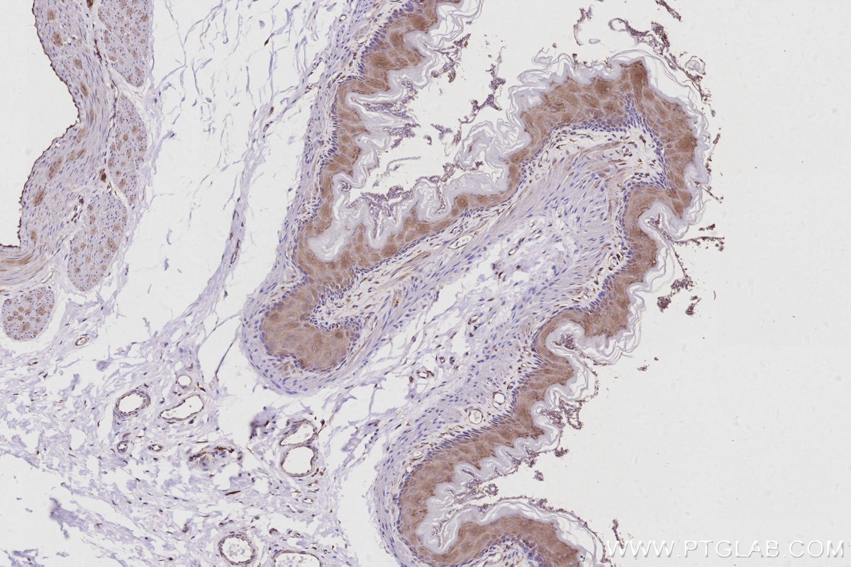 Immunohistochemistry (IHC) staining of rat stomach tissue using ARL8B Polyclonal antibody (13049-1-AP)