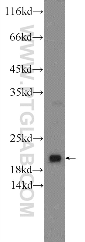 Western Blot (WB) analysis of fetal human brain tissue using ARL8B Polyclonal antibody (13049-1-AP)