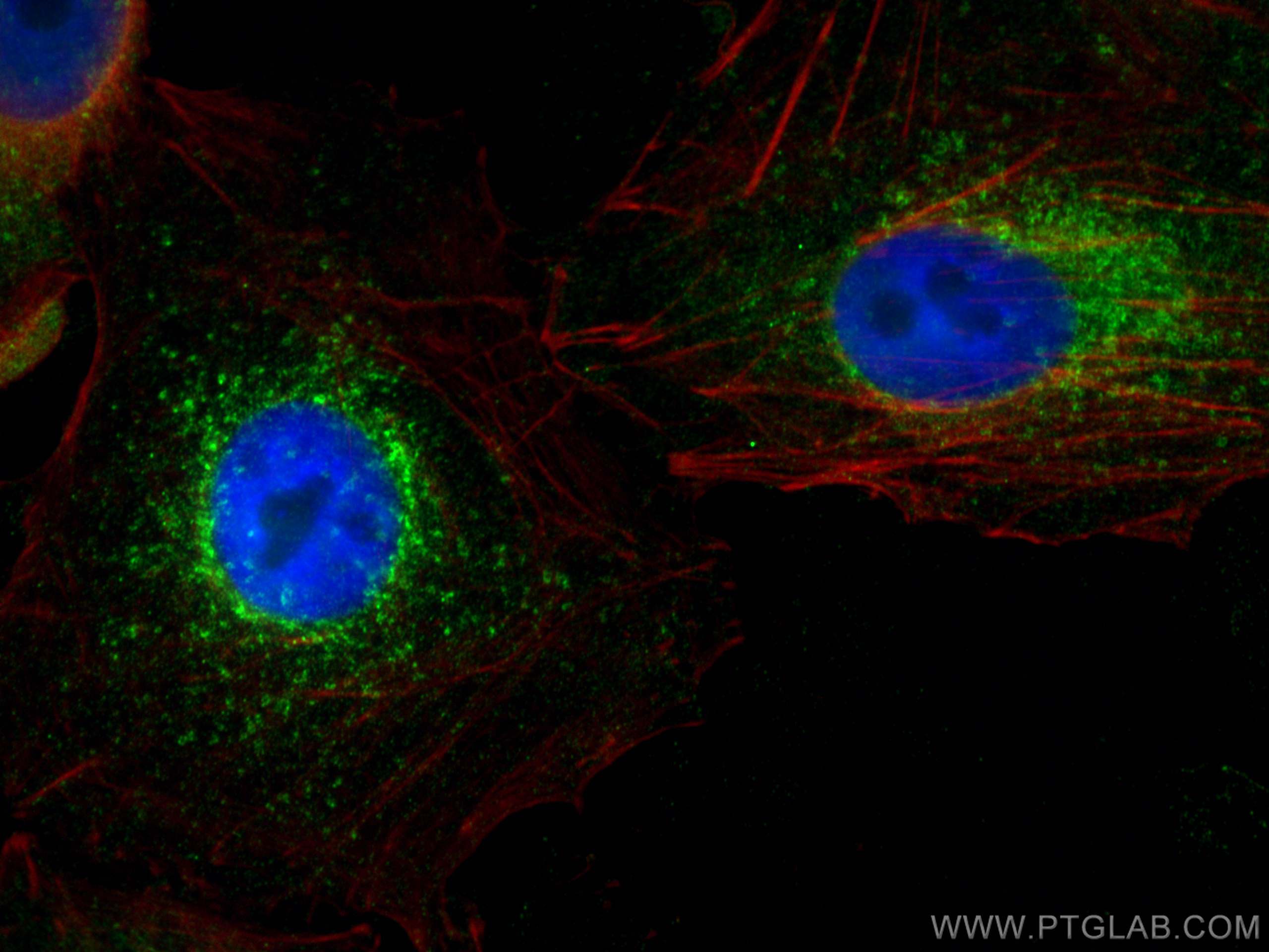 Immunofluorescence (IF) / fluorescent staining of A549 cells using ARL8B Monoclonal antibody (67891-1-Ig)