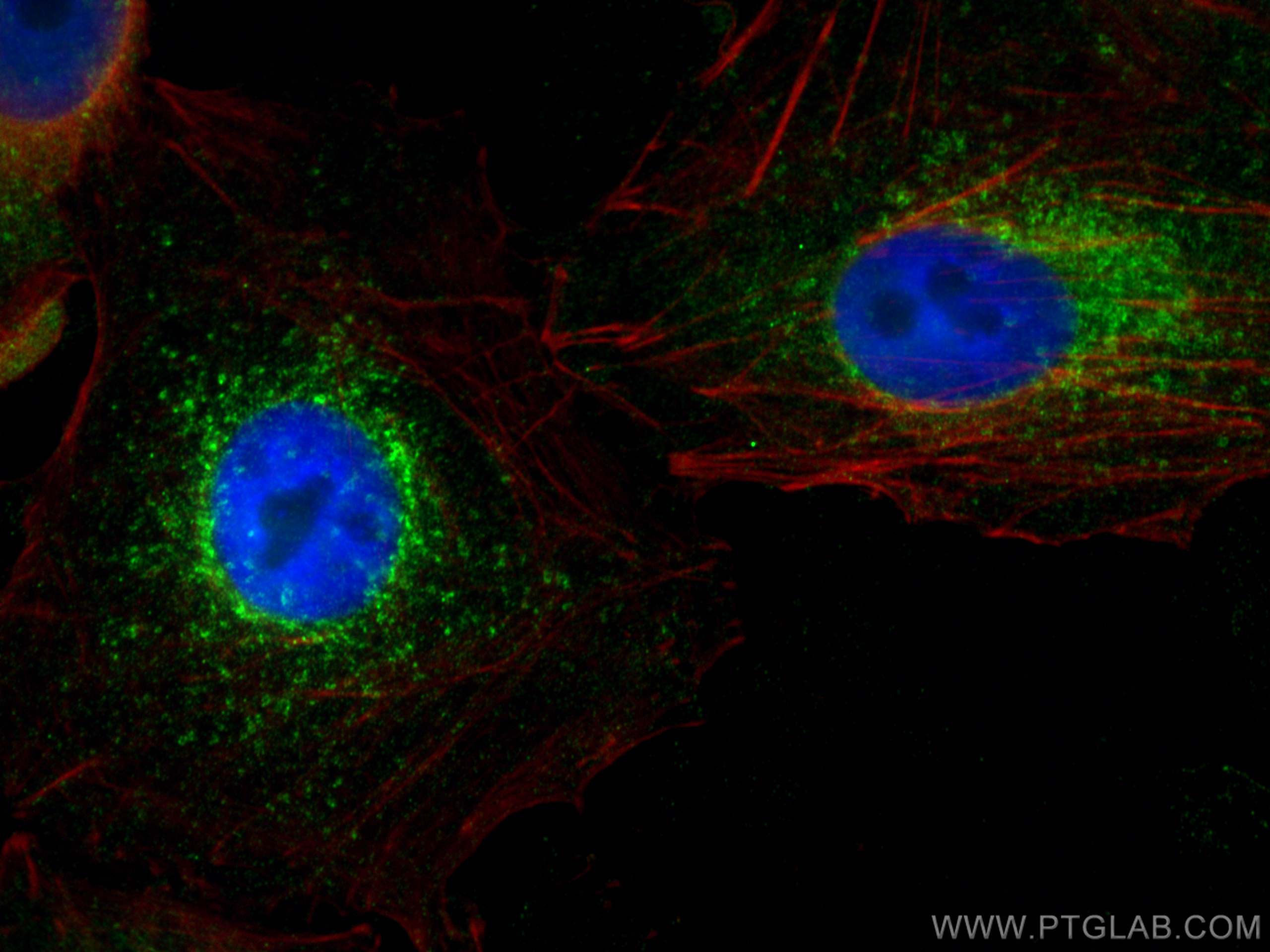 IF Staining of A549 using 67891-1-Ig