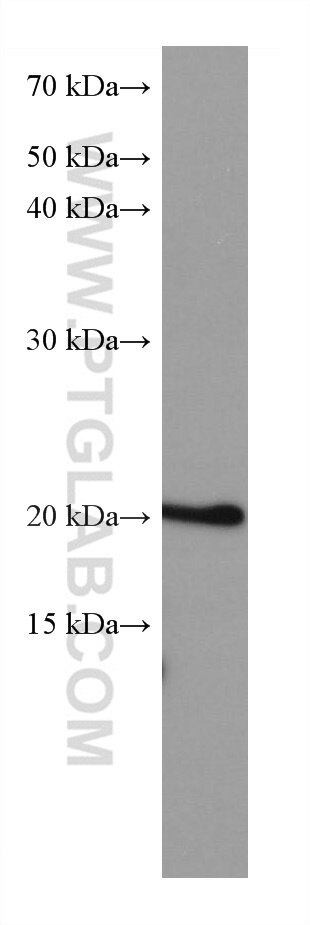 Western Blot (WB) analysis of LNCaP cells using ARL8B Monoclonal antibody (67891-1-Ig)