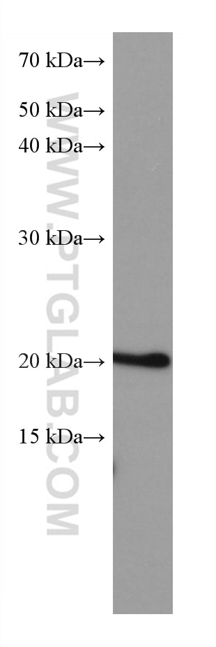 WB analysis of LNCaP using 67891-1-Ig