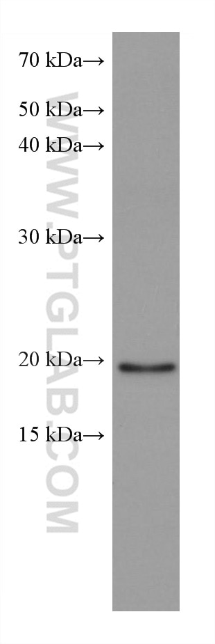 Western Blot (WB) analysis of Jurkat cells using ARL8B Monoclonal antibody (67891-1-Ig)