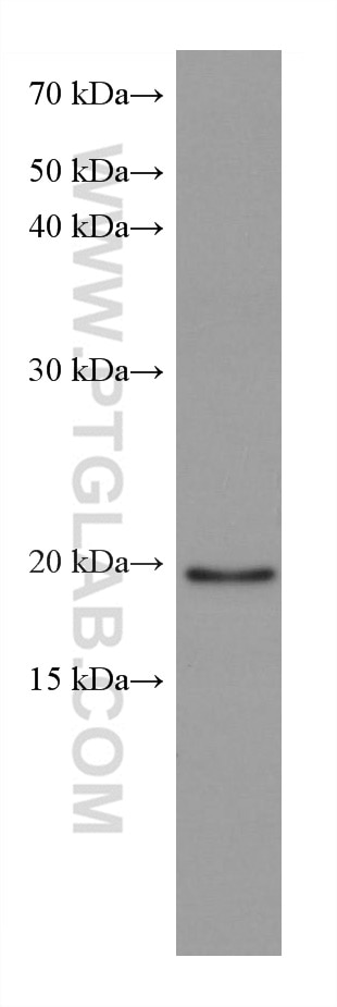 WB analysis of Jurkat using 67891-1-Ig