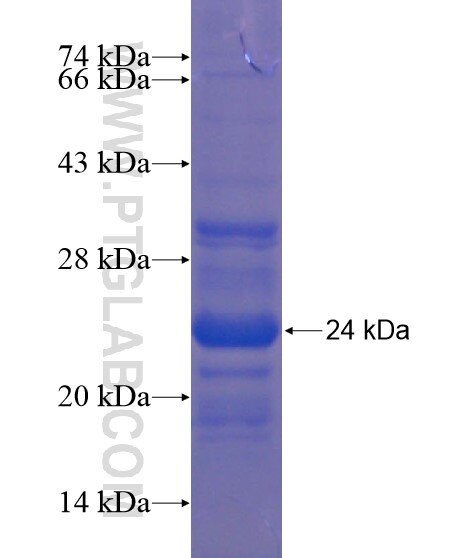 ARL8B fusion protein Ag18758 SDS-PAGE