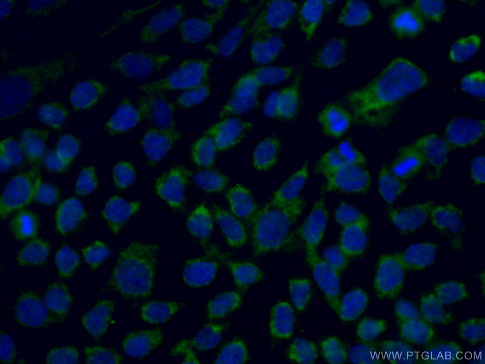 Immunofluorescence (IF) / fluorescent staining of A431 cells using ARMC10 Polyclonal antibody (20506-1-AP)