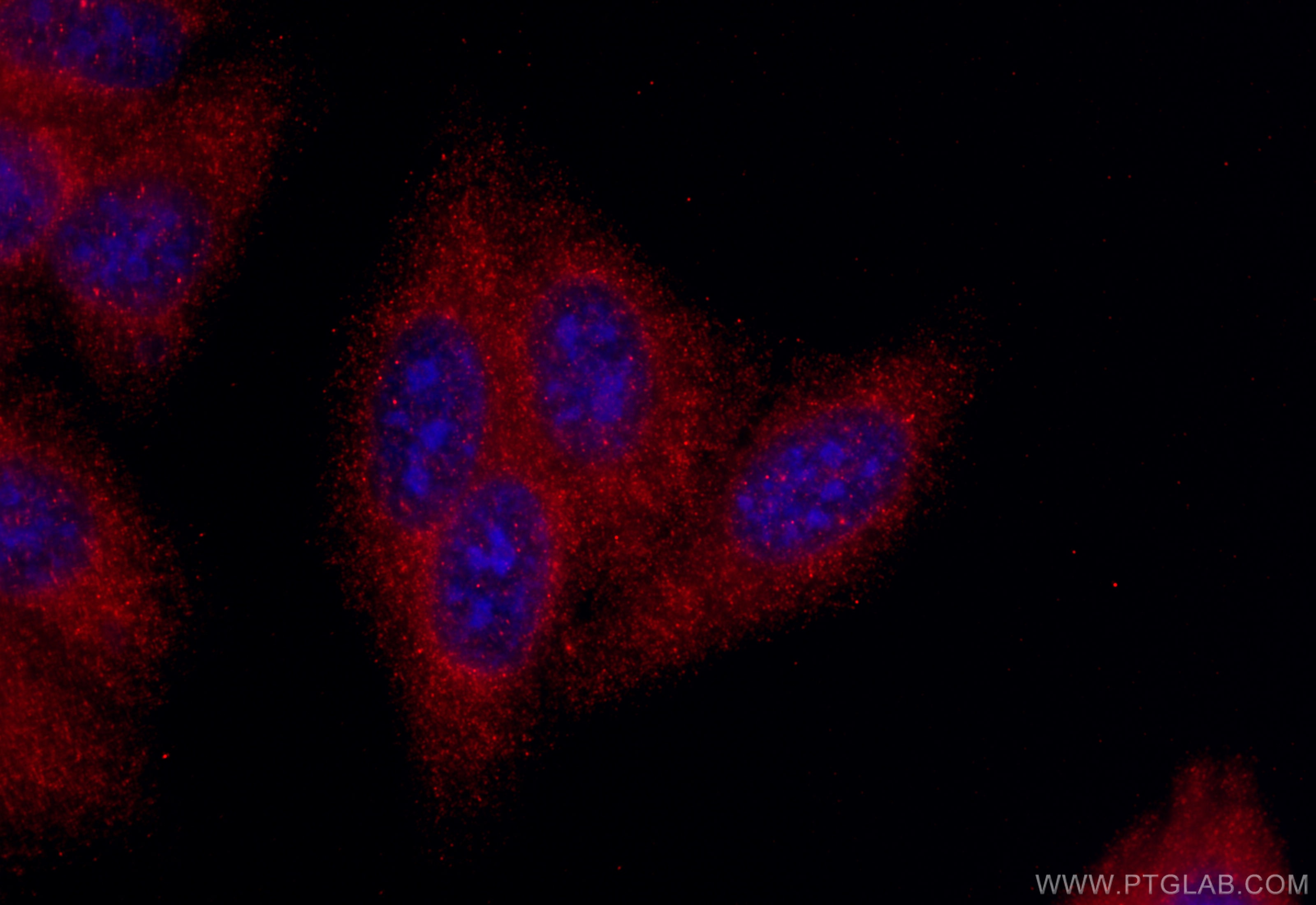 Immunofluorescence (IF) / fluorescent staining of HepG2 cells using ARMC10 Polyclonal antibody (20506-1-AP)