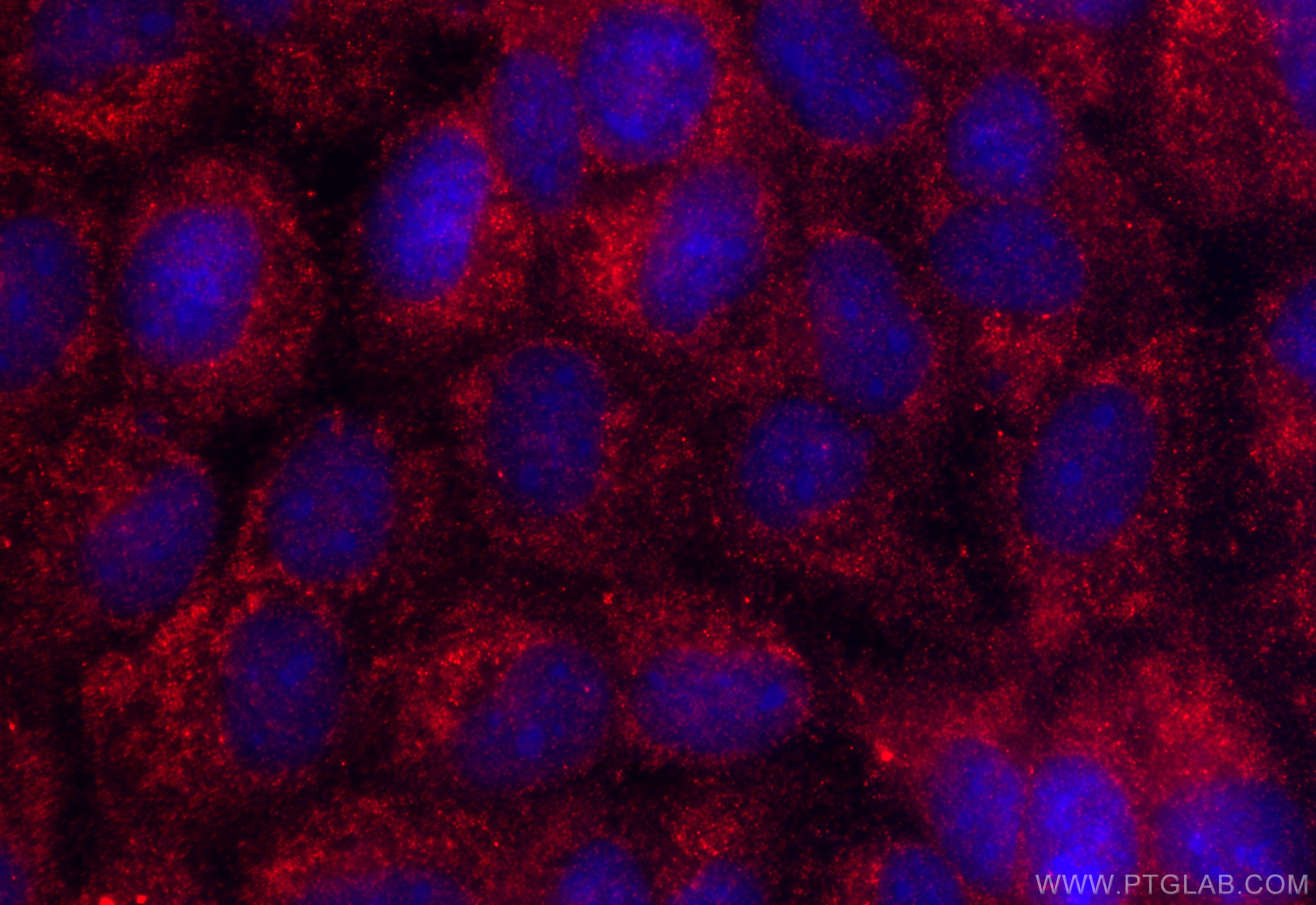 Immunofluorescence (IF) / fluorescent staining of A431 cells using ARMC10 Polyclonal antibody (20506-1-AP)