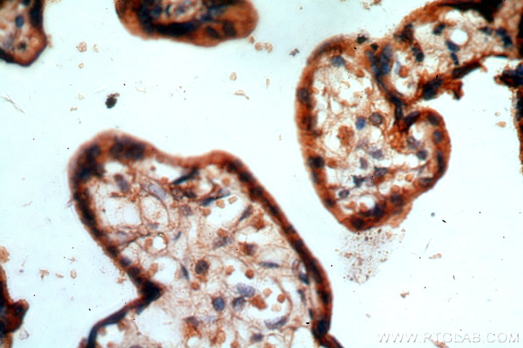 Immunohistochemistry (IHC) staining of human placenta tissue using ARMC10 Polyclonal antibody (20506-1-AP)