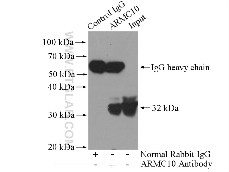 Immunoprecipitation (IP) experiment of A431 cells using ARMC10 Polyclonal antibody (20506-1-AP)