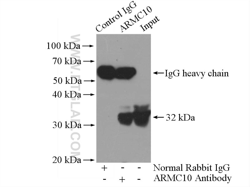 IP experiment of A431 using 20506-1-AP