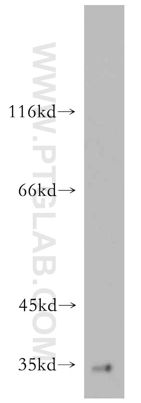 WB analysis of mouse brain using 20506-1-AP