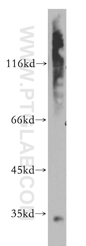 Western Blot (WB) analysis of mouse liver tissue using ARMC10 Polyclonal antibody (20506-1-AP)