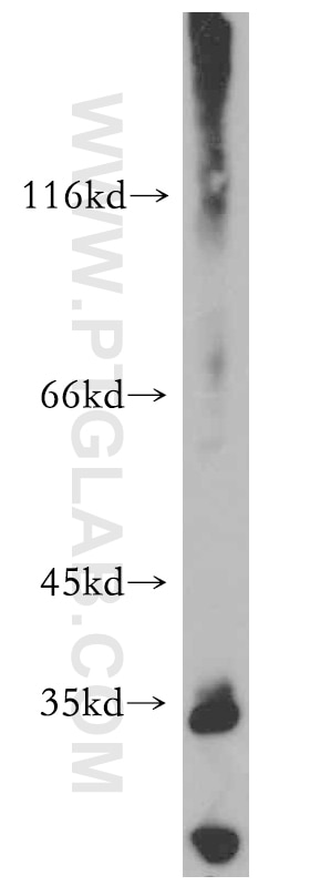 Western Blot (WB) analysis of A431 cells using ARMC10 Polyclonal antibody (20506-1-AP)