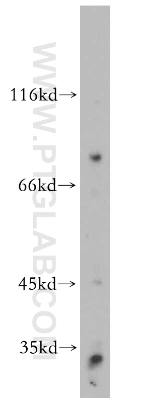 Western Blot (WB) analysis of HEK-293 cells using ARMC10 Polyclonal antibody (20506-1-AP)