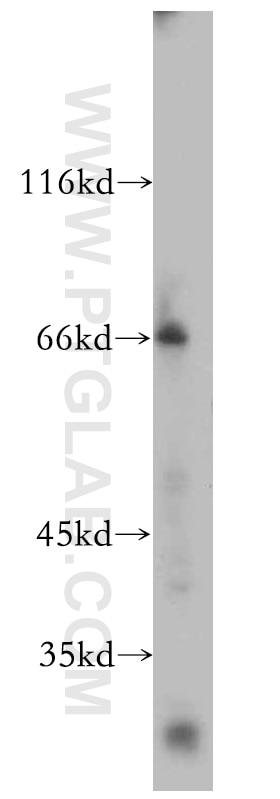 Western Blot (WB) analysis of HepG2 cells using ARMC10 Polyclonal antibody (20506-1-AP)