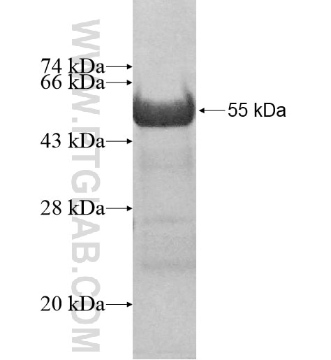 ARMC10 fusion protein Ag14313 SDS-PAGE