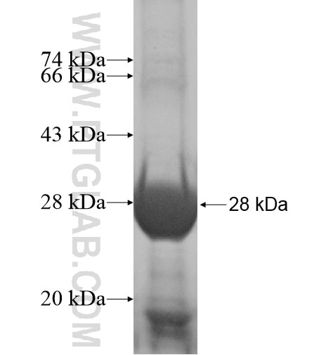 ARMC10 fusion protein Ag14372 SDS-PAGE