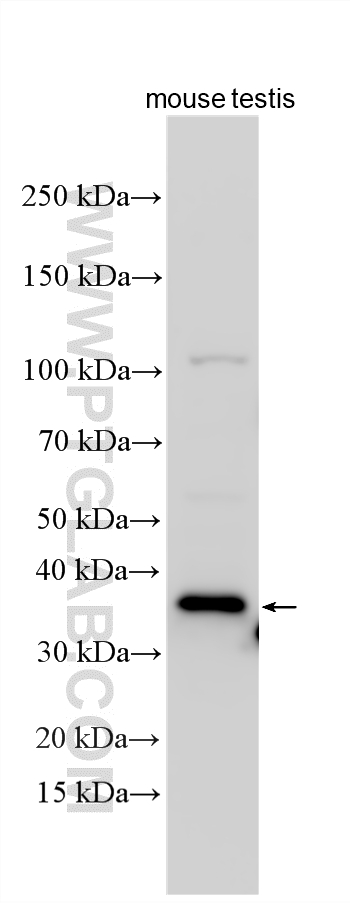 WB analysis using 33045-1-AP Western Blot (WB) analysis of various lysates using ARMC12 Polyclonal antibody (33045-1-AP)