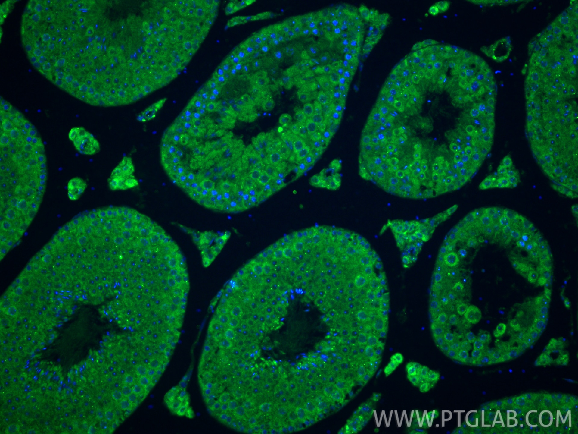 IF Staining of mouse testis using 24011-1-AP (same clone as 24011-1-PBS) Immunofluorescence (IF) / fluorescent staining of mouse testis tissue using ARMC2 Polyclonal antibody (24011-1-AP)