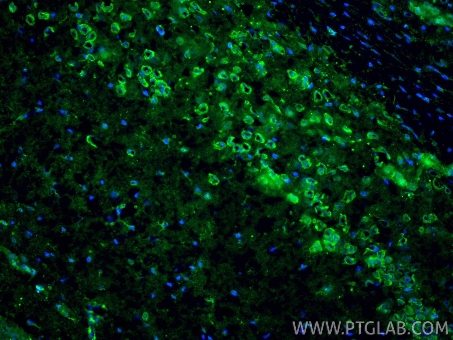IF Staining of mouse brain using 24011-1-AP (same clone as 24011-1-PBS) Immunofluorescence (IF) / fluorescent staining of mouse brain tissue using ARMC2 Polyclonal antibody (24011-1-AP)