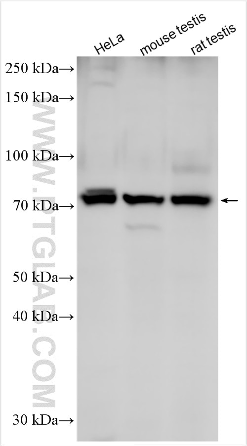 WB analysis using 24011-1-AP (same clone as 24011-1-PBS) Western Blot (WB) analysis of various lysates using ARMC2 Polyclonal antibody (24011-1-AP)