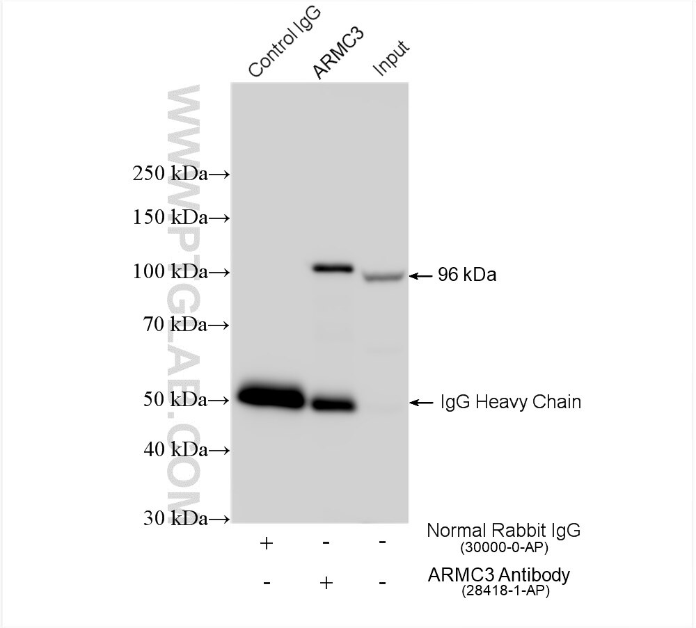 Immunoprecipitation (IP) experiment of mouse testis tissue using ARMC3 Polyclonal antibody (28418-1-AP)