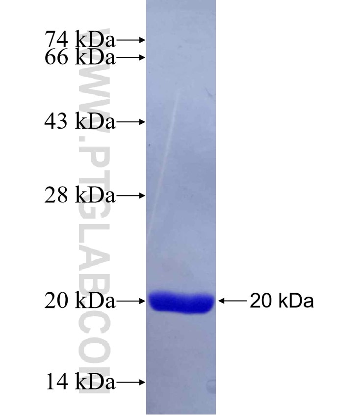 ARMC3 fusion protein Ag29278 SDS-PAGE