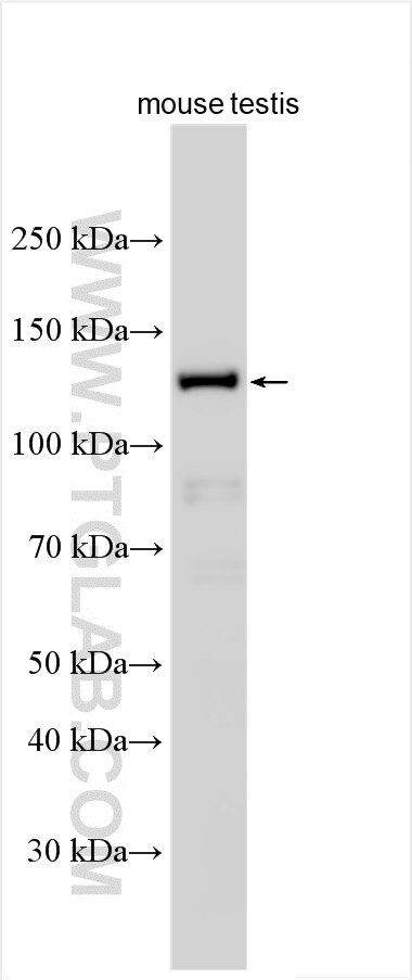 Western Blot (WB) analysis of mouse testis tissue using ODAD2 Polyclonal antibody (25641-1-AP)