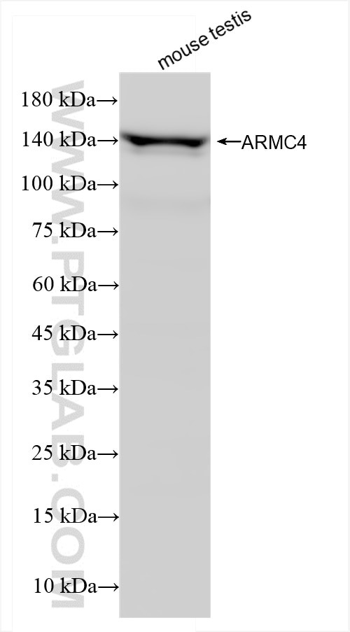 Western Blot (WB) analysis of mouse testis tissue using ARMC4 Recombinant antibody (84004-3-RR)