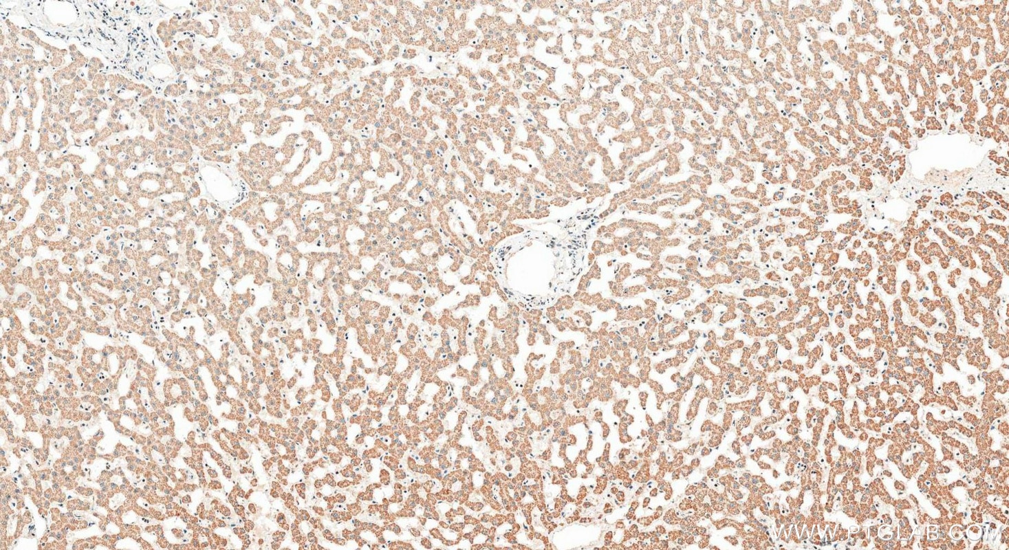Immunohistochemistry (IHC) staining of human liver tissue using ARMC5 Polyclonal antibody (24833-1-AP)