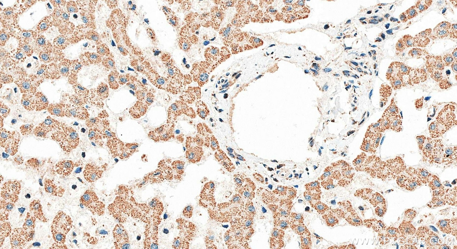 Immunohistochemistry (IHC) staining of human liver tissue using ARMC5 Polyclonal antibody (24833-1-AP)
