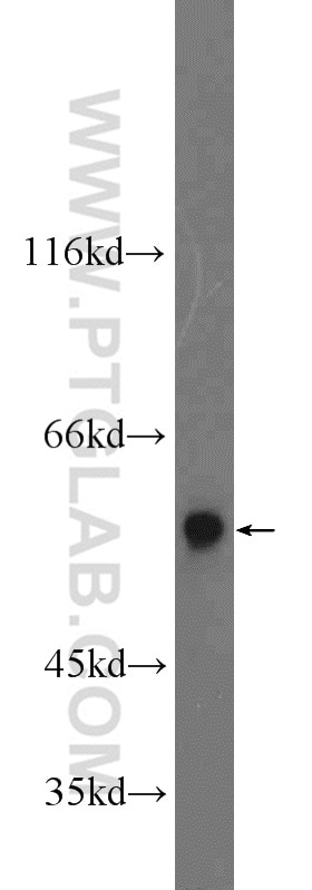Western Blot (WB) analysis of A2780 cells using ARMC5 Polyclonal antibody (24833-1-AP)