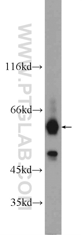 Western Blot (WB) analysis of HepG2 cells using ARMC5 Polyclonal antibody (24833-1-AP)