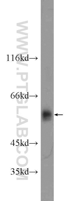 Western Blot (WB) analysis of mouse liver tissue using ARMC5 Polyclonal antibody (24833-1-AP)