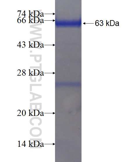 ARMC5 fusion protein Ag21171 SDS-PAGE