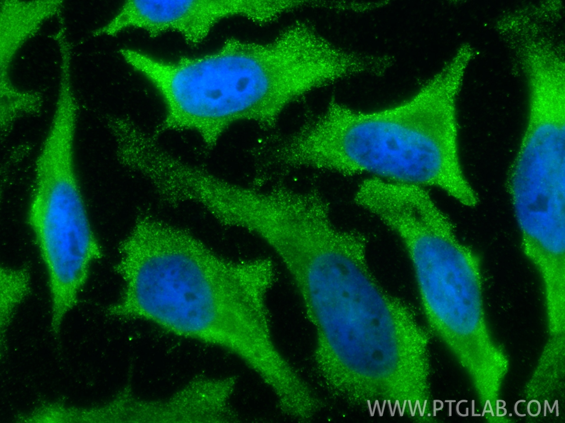 Immunofluorescence (IF) / fluorescent staining of HeLa cells using ARMC6 Polyclonal antibody (25558-1-AP)