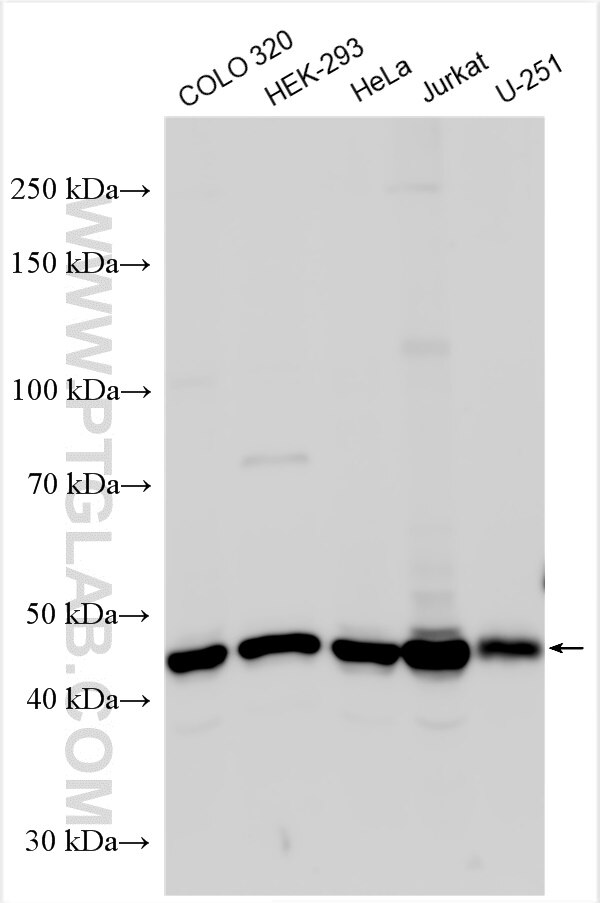 Western Blot (WB) analysis of various lysates using ARMC6 Polyclonal antibody (25558-1-AP)