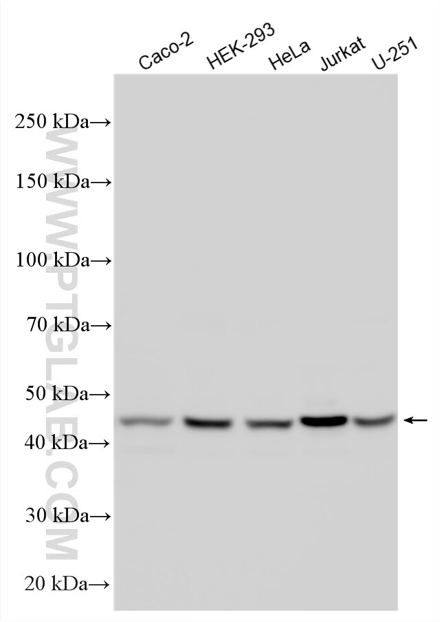 Western Blot (WB) analysis of various lysates using ARMC6 Polyclonal antibody (25558-1-AP)